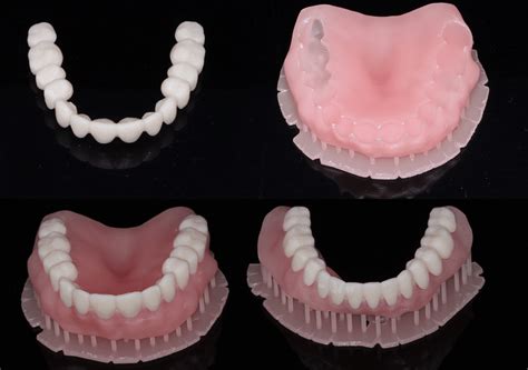 3d printed dentures reviews|3D printed complete removable dental prostheses: a .